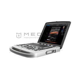 Chison Sonotouch 80 (SonoBook 6)