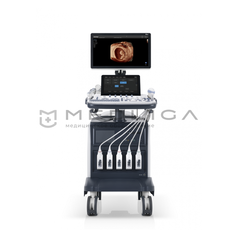 SonoScape S60, Сегмент: Частный, 3